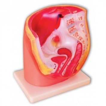 MEDIAN SECTION OF FEMALE PELVIS